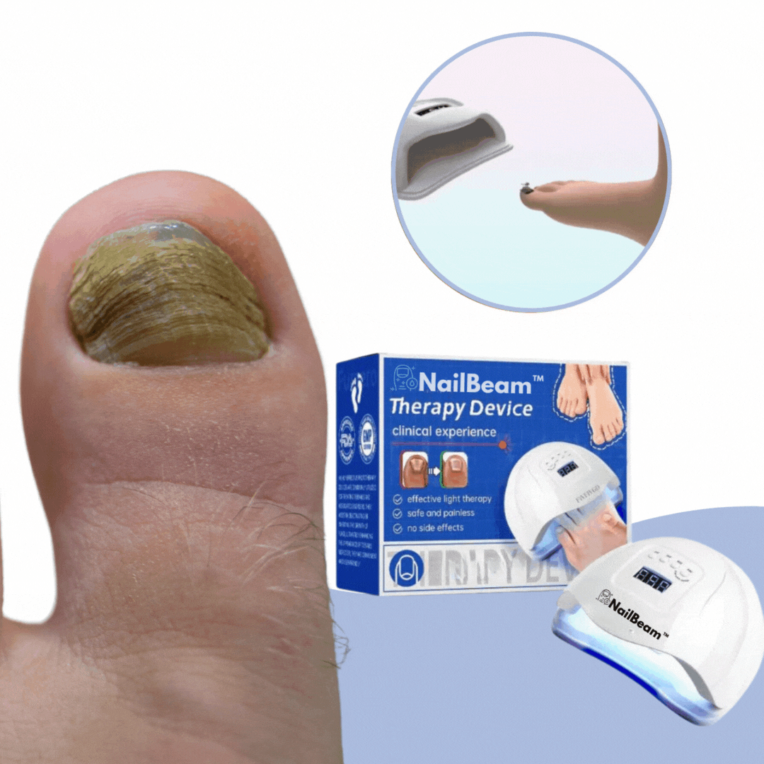 NailBeam™️ IL