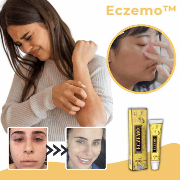Eczemo™