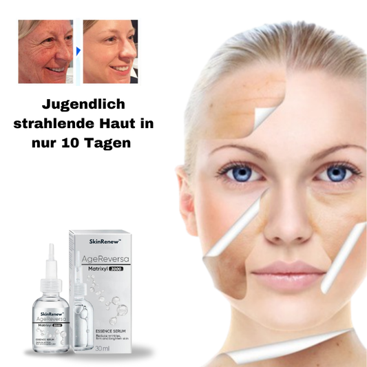 SkinRenew™ IL