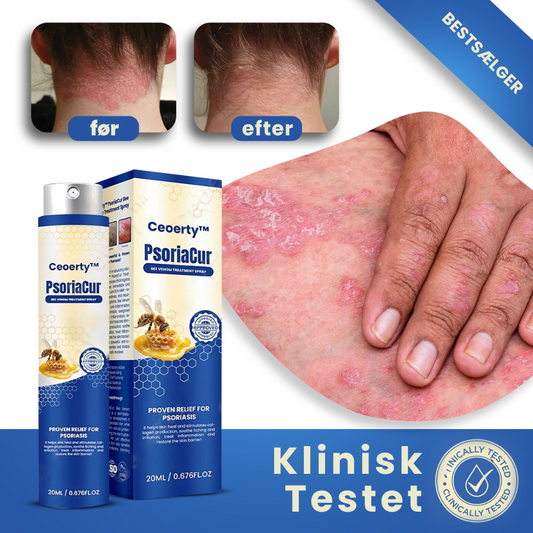 PsoriaEase™