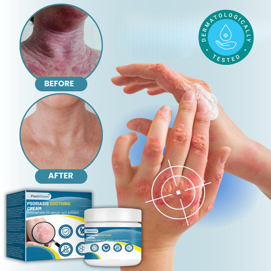 PsoriOtium®